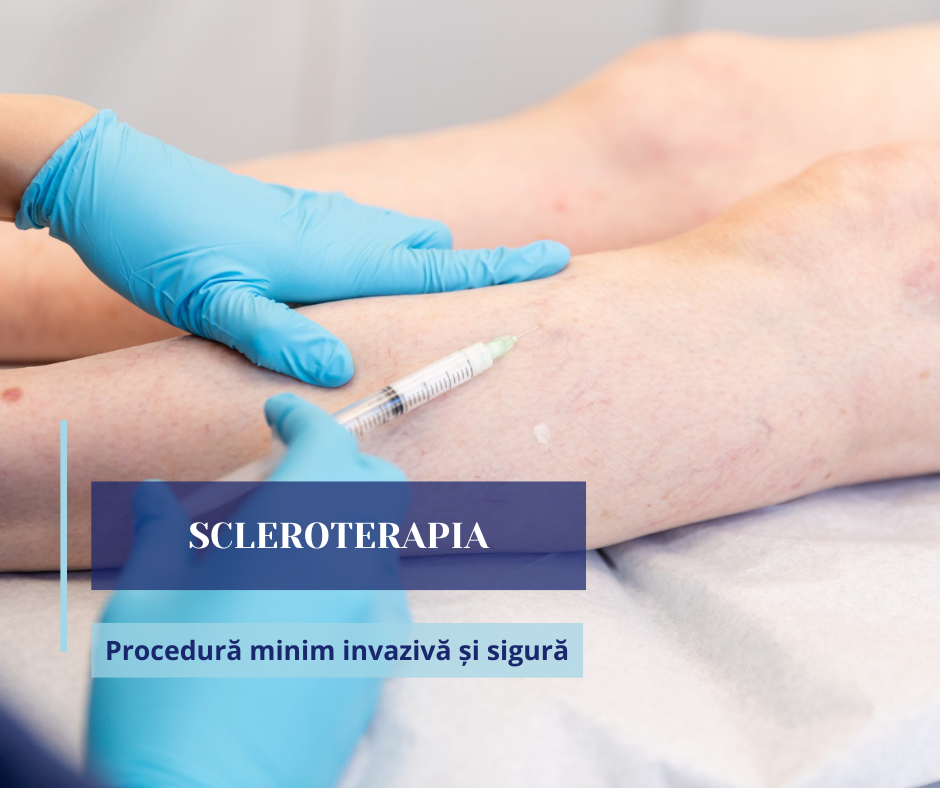 chirurgie-vasculara-2