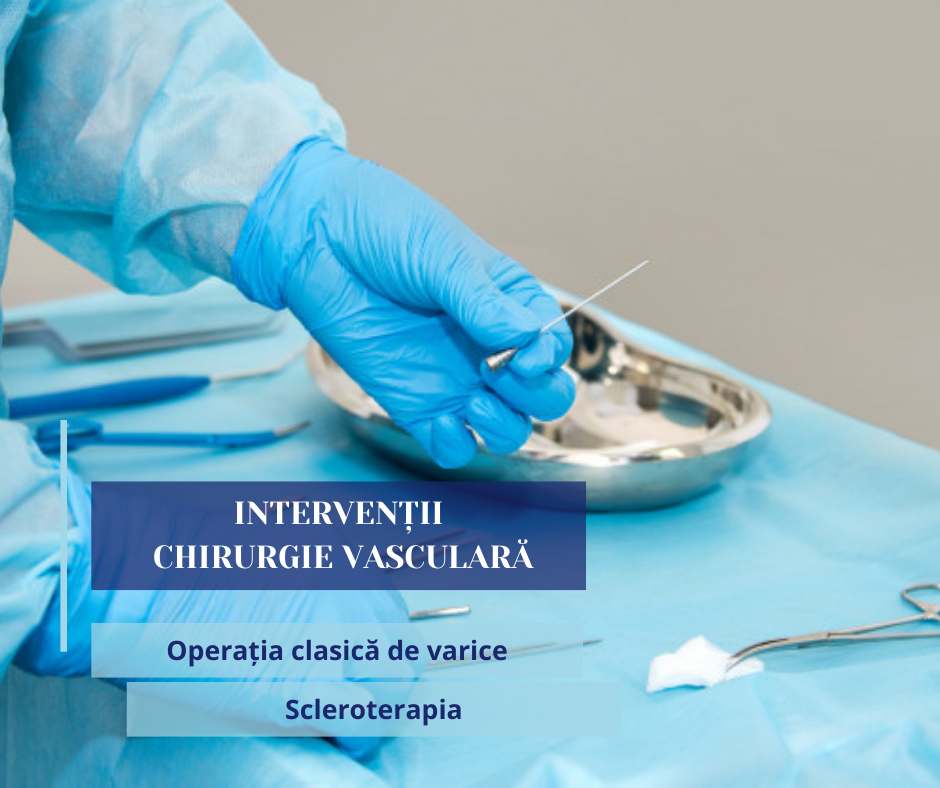 chirurgie-vasculara